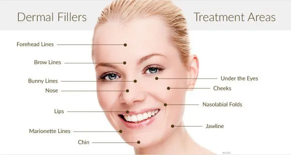 Dermal Filler Tx Areas