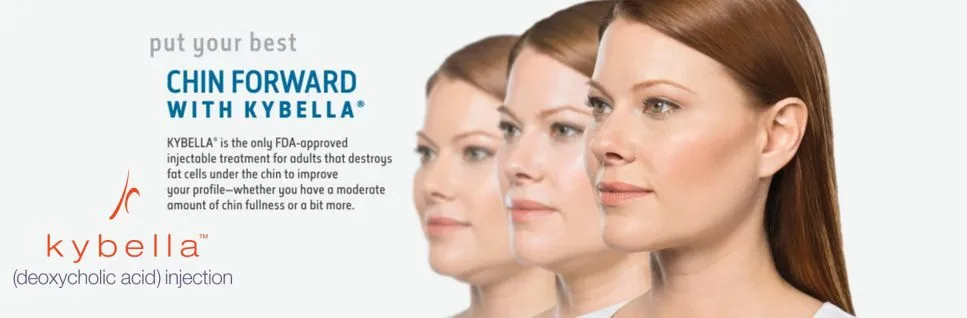 Kybella Injections