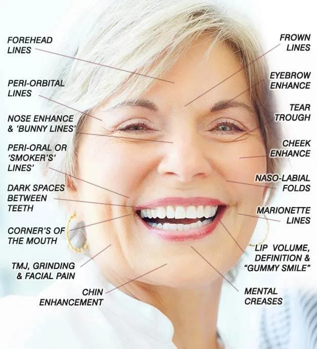 older women Botox areas