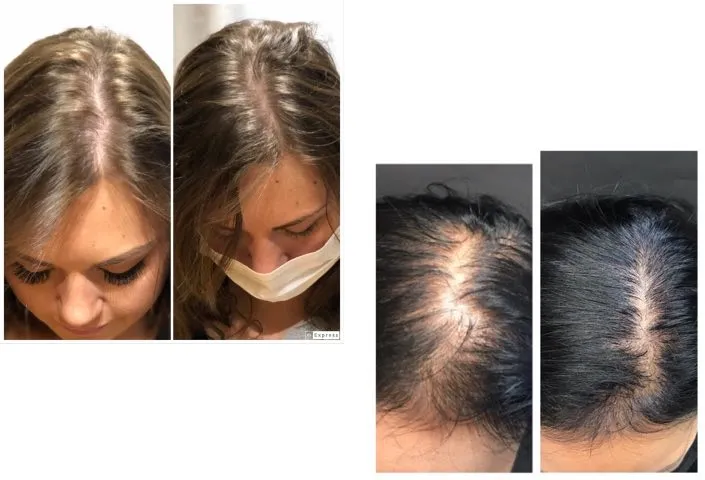 before-afters-hair-rejuvinationn