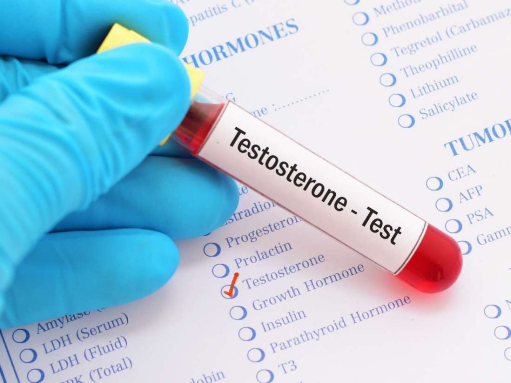 testosterone test